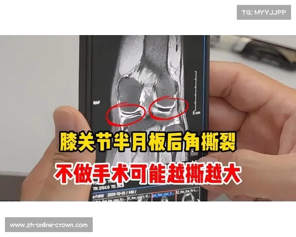 蓝军锋线主力恩昆库半月板受伤将接受膝盖手术艰难复出在即 蓝军锋线主力恩昆库半月板受伤将接受膝盖手术艰难复出在即